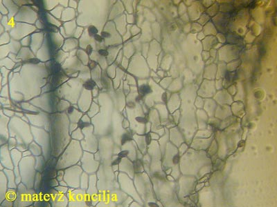 Stemonitis lignicola - Capillitium