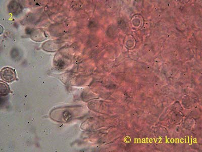 russula lilacea - cistide