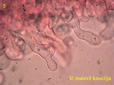 crepidotus luteolus - kajlocistide