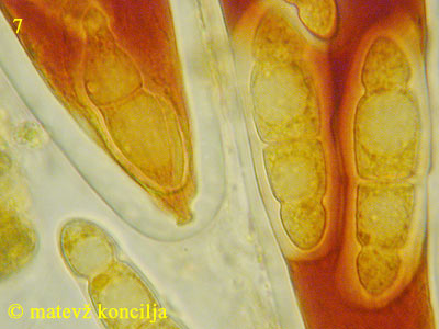 Asteromassaria macrospora - Apikalring