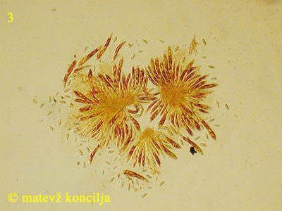 asteromassaria macrospora - aski