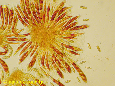 Asteromassaria macrospora - Asci