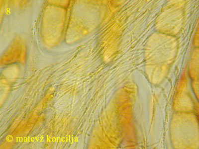 Asteromassaria macrospora - Paraphysen