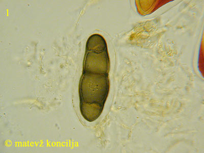Asteromassaria macrospora - Spore