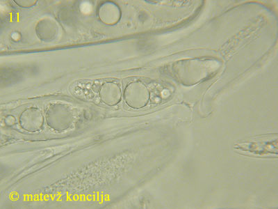 Asteromassaria macrospora - Spore