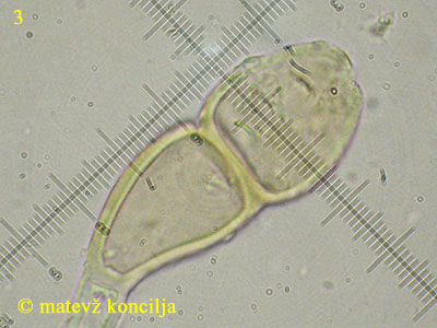 Puccinia malvacearum - teliospora