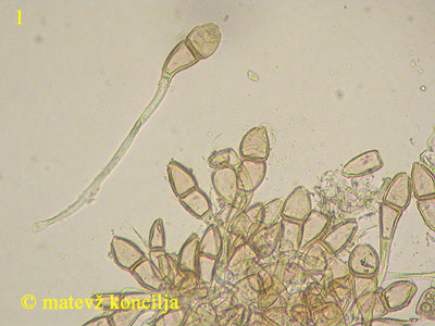 Puccinia malvacearum - teliospore