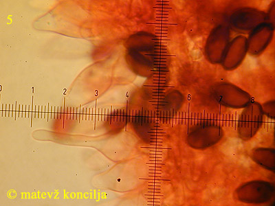 Psathyrella microrhiza - kajlocistide