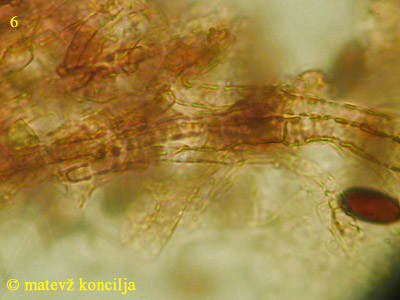 Psathyrella microrhiza - trama lističa