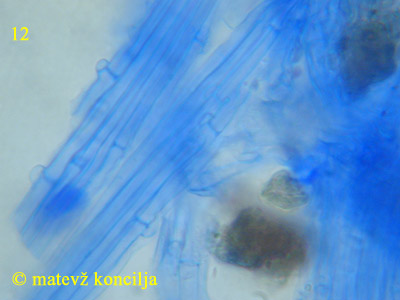 Psathyrella microrhiza - hife koreninic