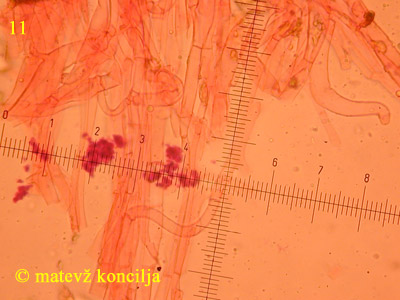 Psathyrella microrhiza - velum