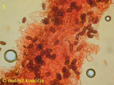 Psathyrella microrhiza - cistide