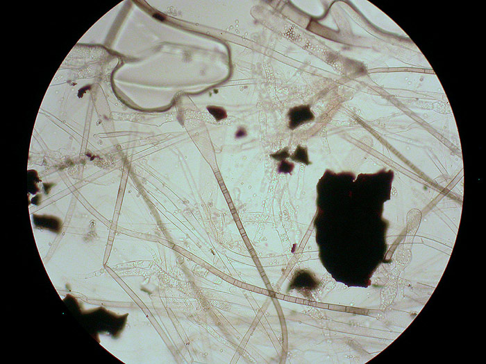 Mycotypha microspora