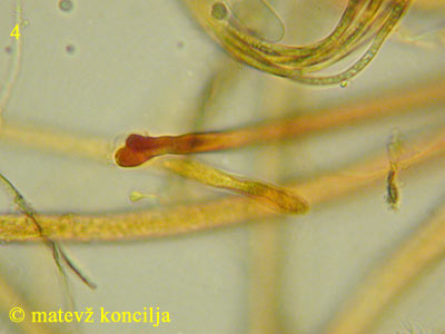 Lophium mytilinum - Ascusbasis