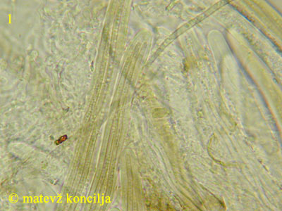Lophium mytilinum - Sporen