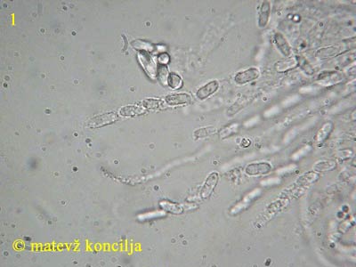 Nectriopsis violacea - Sporen