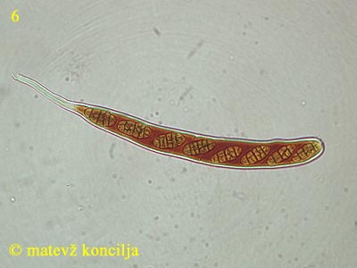 Cucurbitaria obducens - Ascus