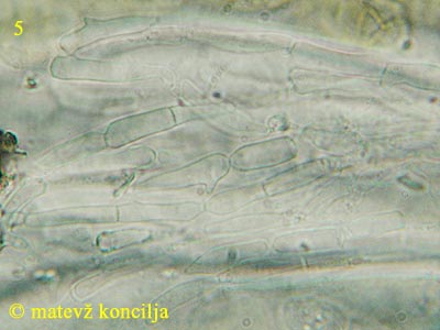 Cucurbitaria obducens - Paraphysen