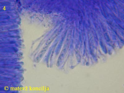 Orbilia coccinella - Asci