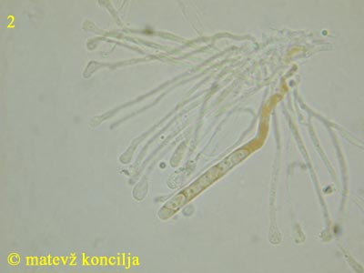 Orbilia coccinella - Ascus