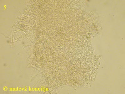 Orbilia coccinella - Hymenium mit Excipulum