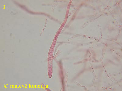 Russula paludosa - dermatocistide