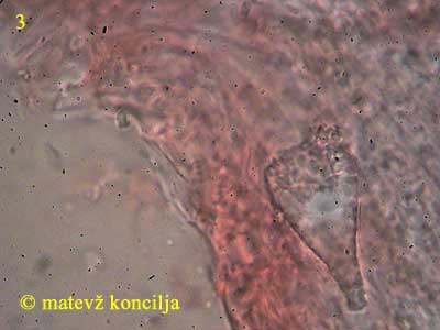 peniophora quercina - Lamprozystiden