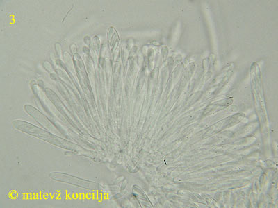 Pyrenopeziza petiolaris - aski/parafize