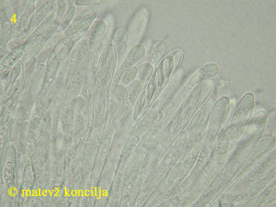 Pyrenopeziza petiolaris - aski/parafize