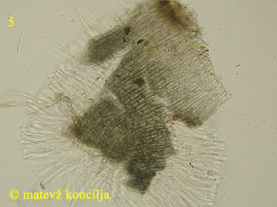 Pyrenopeziza petiolaris - excipulum