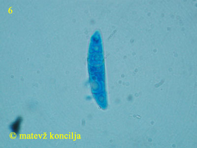 Pezicula livida - Ascospore