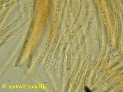 Lophodermium pinastri - Paraphysen