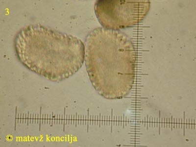 Pucciniastrum areolatum - Aeciosporen