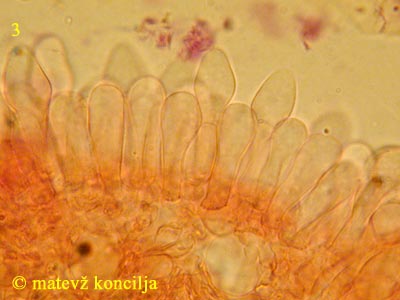 Coprinopsis radiata - bazidiji