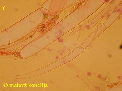 Coprinopsis radiata - hife koice klobuka