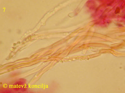 Schizopora radula - Inkrustierte Hyphen