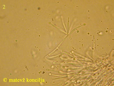 pycnidiella resinae - konidionosci