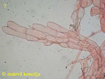 Inocybe rimosa - Kaulozystiden