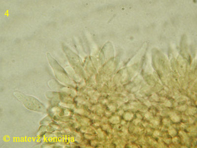 Roridomyces roridus - Cheilozystiden
