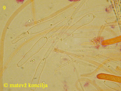 Ampullina rubella - Paraphysen