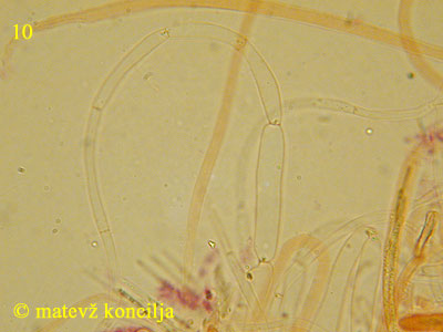Ampullina rubella - Paraphysen