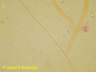 Ampullina rubella - Spore