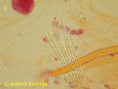 Ampullina rubella -Sporen