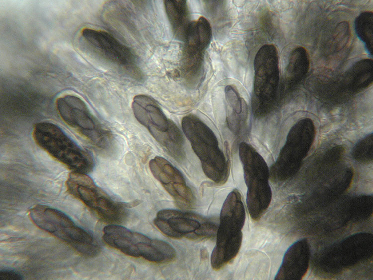 Saccobolus verrucisporus - Warzigsporiges Kotbecherchen