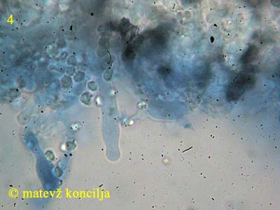 Lyomyces sambuci - Leptozystiden