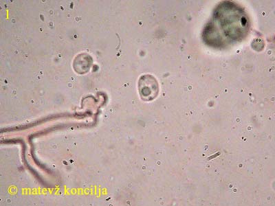Lyomyces sambuci - Sporen