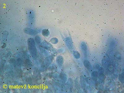 Lyomyces sambuci - Basidie und Sporen