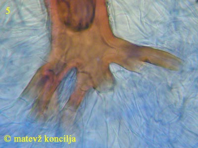 scutellinia scutellata - Haarbasis