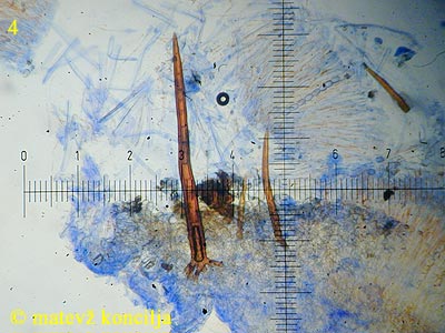 scutellinia scutellata - Haare