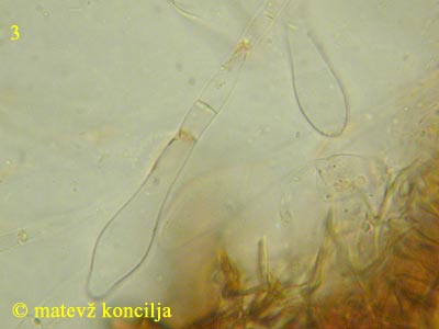 scutellinia scutellata - Paraphysen